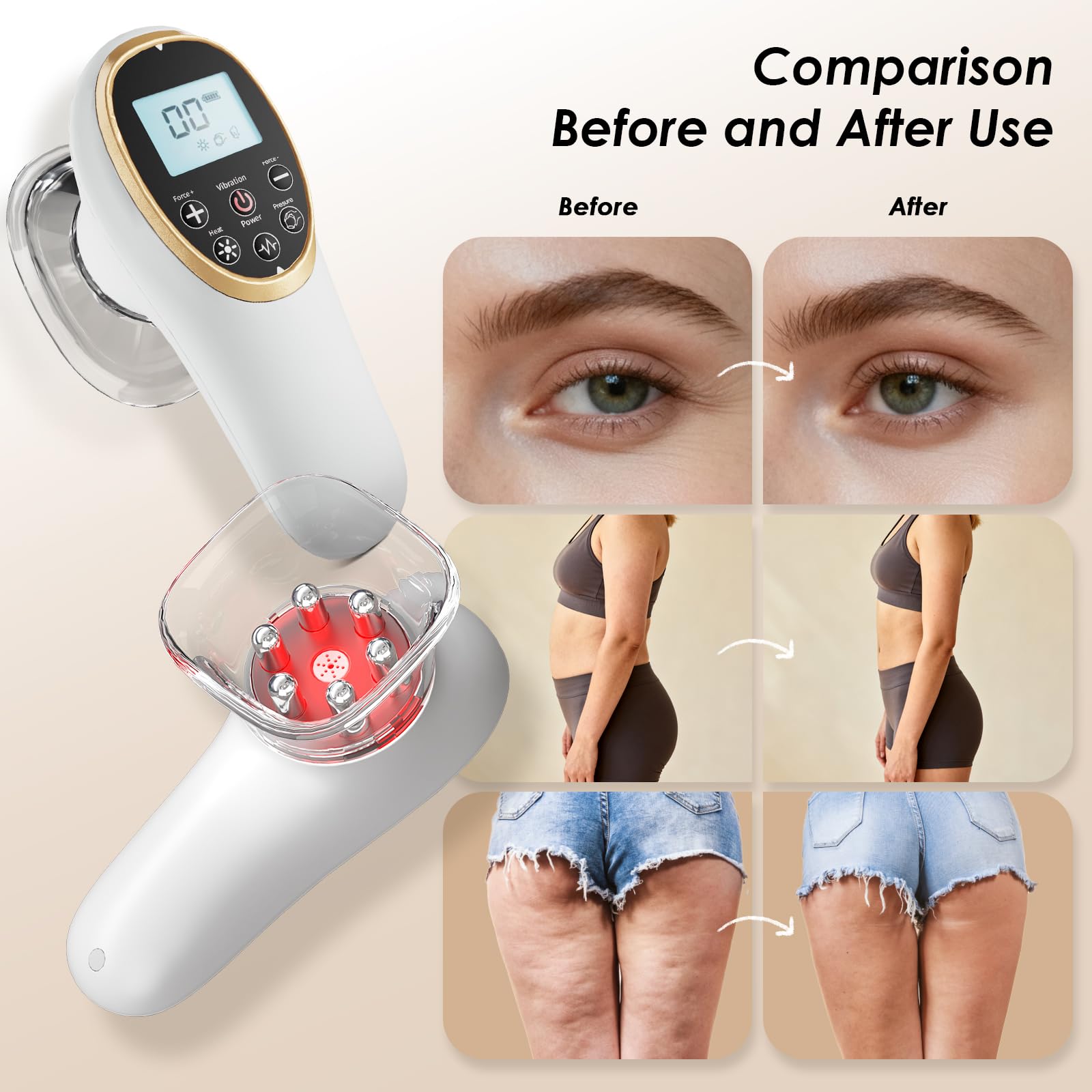 Modern Jingluo Beauty Massager – Electric Meridian Facial & Body Roller with Gentle Suction and Warmth, Multi-Speed Skincare Tool for Relaxing Rituals (White)